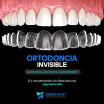 Ortodoncia invisible