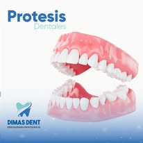Prótesis dentales