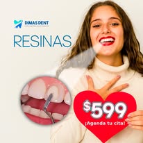 Resinas dentales
